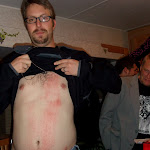 He got a pretty good strawberry from that stunt