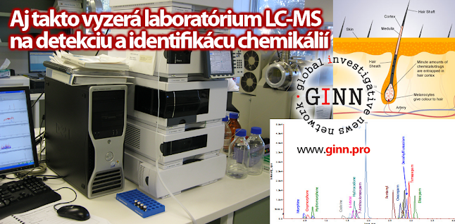 Laboratórium LC-MS slúži aj na detekciu drog