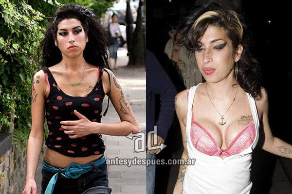 Los pechos operados de Amy Winehouse