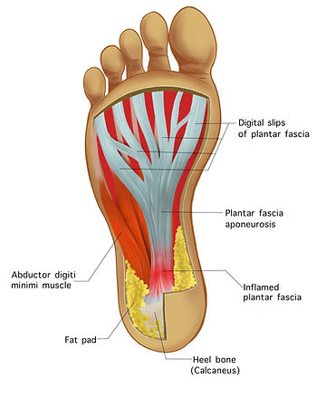 The Plantar Fascia involved in Plantar Fasciitis