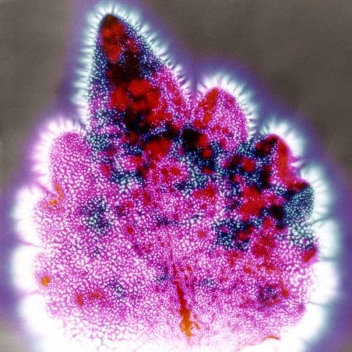 Kirlian Photography