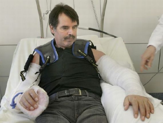 Karl Merk - Double Arm Transplant In The World