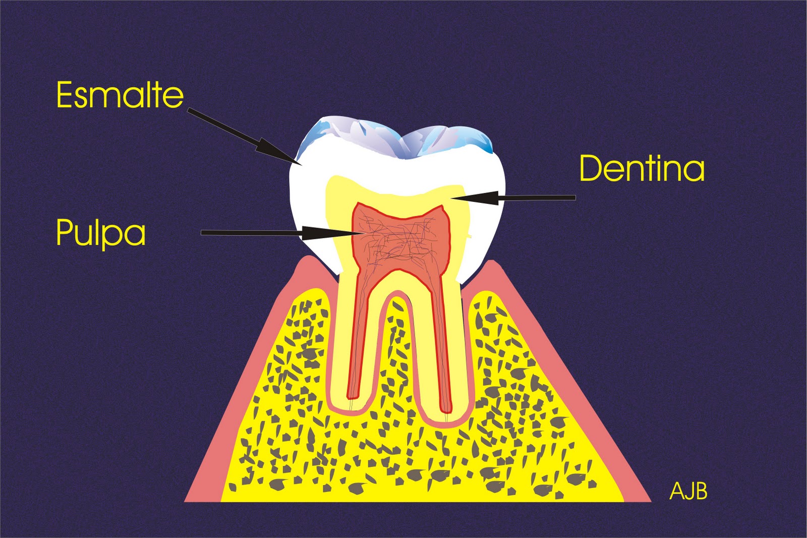 Cuidado Dental ¿Que es una endodoncia?