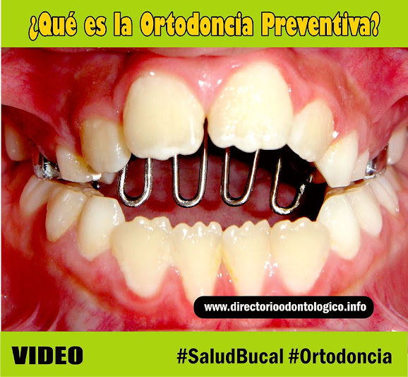 ortodoncia-preventiva
