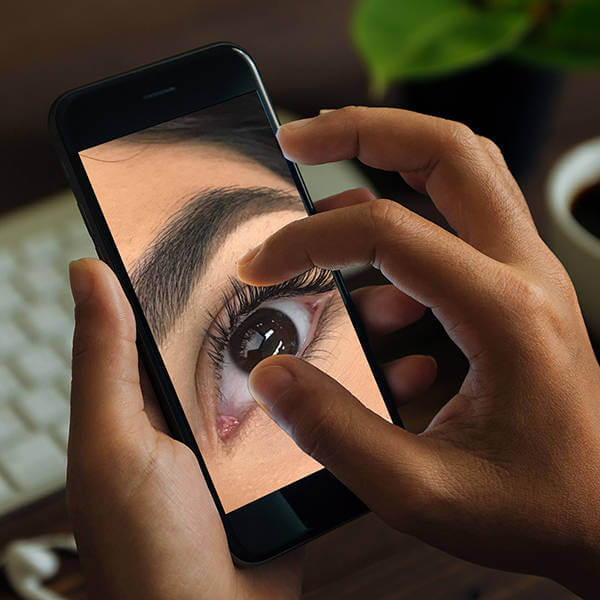 You can use a phone to take overall customer’s face instead of a macro lens
