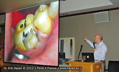 Docteur Eric Hazan, chirurgien-dentiste / dental surgeon, Paris 16, France, conference