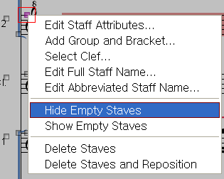 Staff - Hide Empty Staves - Popup.png
