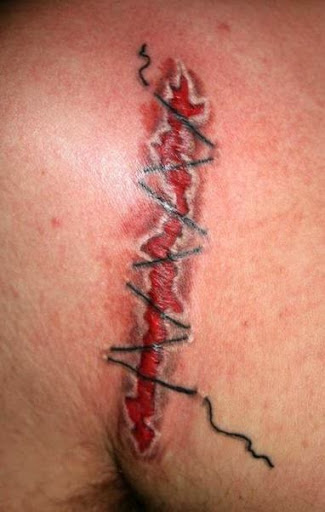 Scar tattoos