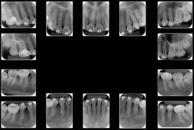 Photos of Cl&iacute;nica X Dent