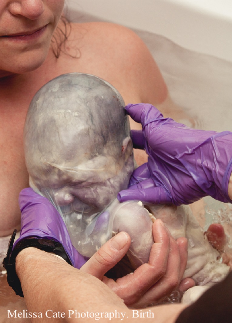 10 Extraordinary Photos of Babies Born in the Amniotic Sac