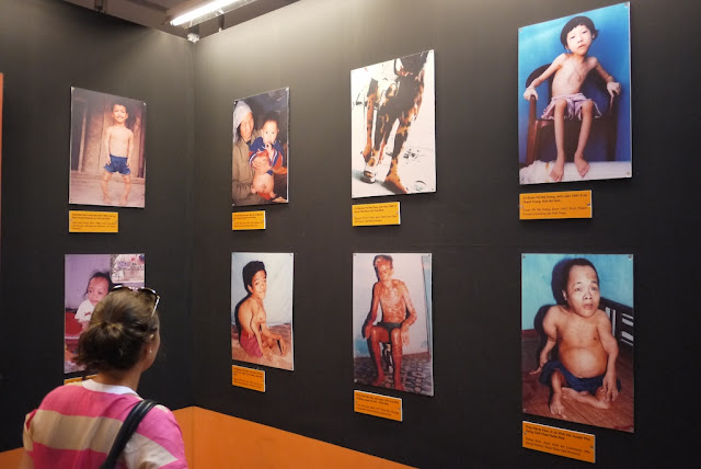 woman looking at photos of children with deformities.