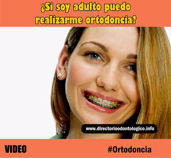 ortodoncia-adulto
