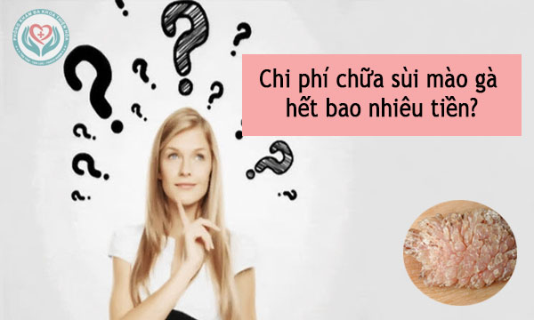 chi phí chữa sùi mào gà