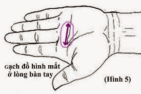 Bấm huyệt chữa cận thị trên lòng bàn tay