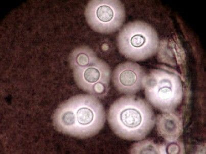 [Image: Cryptococcus.jpg]