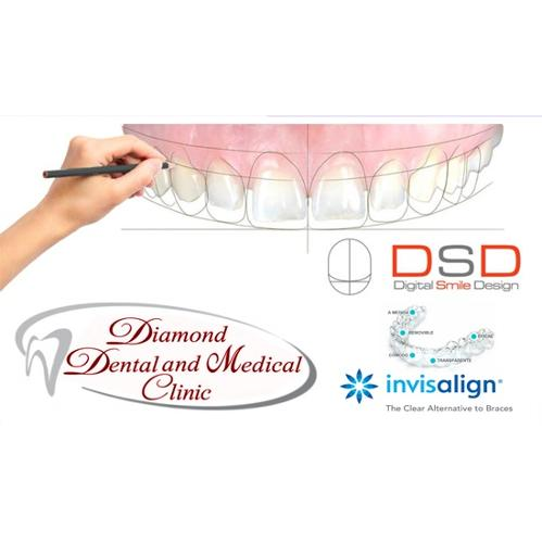 Diamond Dental & Medical Clinic