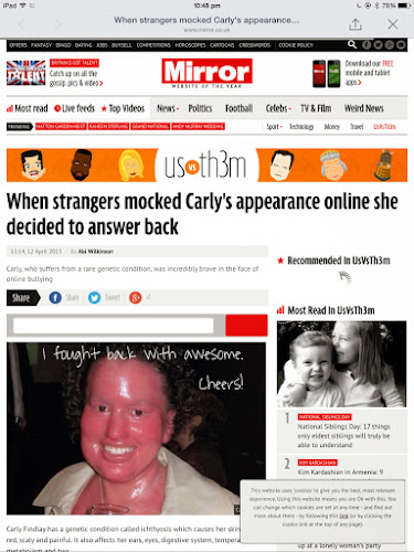 Daily Mirror article about Carly Findlay 