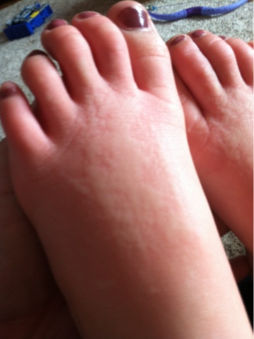 It's A Windy View: Buzz Off Hives
