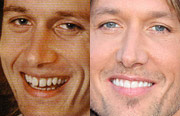 Celebrity Teeth Before and After