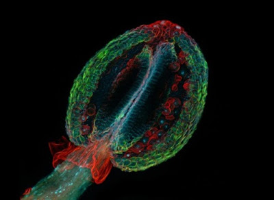 FastStoneEditor Foto foto 
mikroskop elektron (2) : Sel dan jaringan makhluk hidup