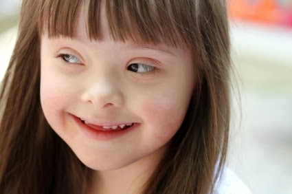 99% de los síndrome de Down son felices con sus vidas, el 90% son abortados