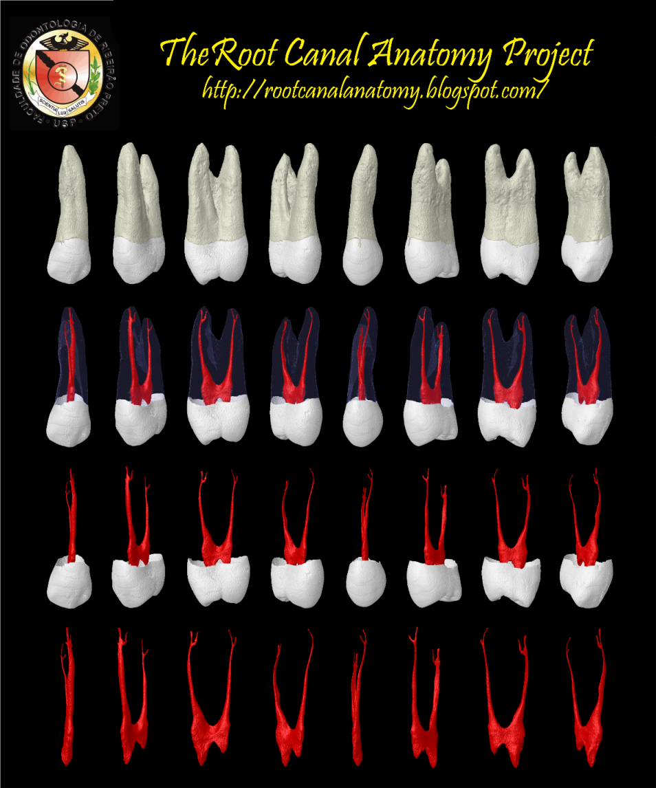 Maxillary First Premolar Root Canal Anatomy