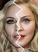 Celebrities who use botox