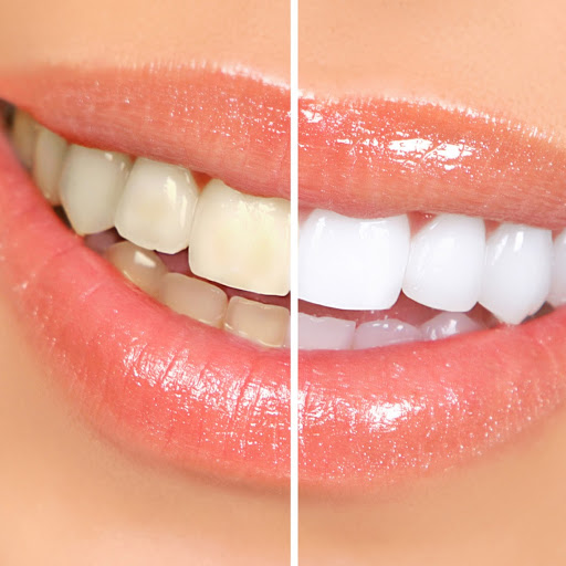 The Pearly White Teeth Whitening Company logo