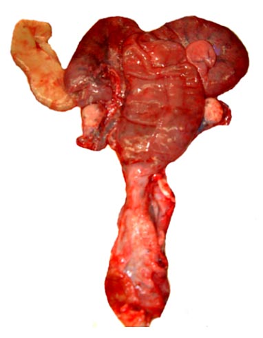Pregnant uterus with twin fetuses from posterior. Note the large pink ovaries