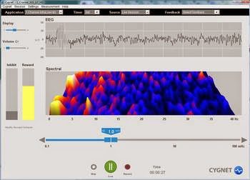 neurofeedback