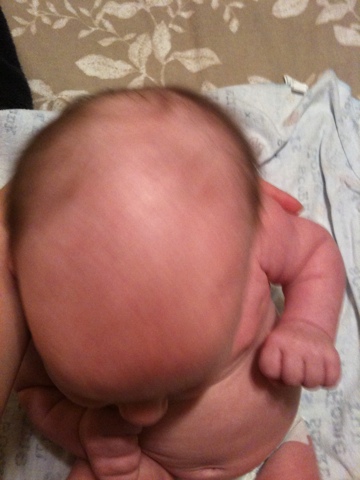 My baby is losing his hair in a funny pattern! - First Time Mom and Dad