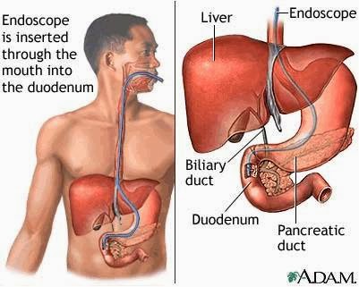 Gastroenterologist In Ashok Vihar, Liver Specialist In Ashok Vihar, Gastroenterologist In Delhi, C-3-68, Phase 2, Pocket C 3, Phase 2, Ashok Vihar, Delhi, 110052, India, Gastroenterologist, state UP