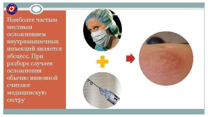Как выглядит абсцесс после укола Коррекция ягодиц с помощью эндопротезирования: преимущества и недостатки Estet