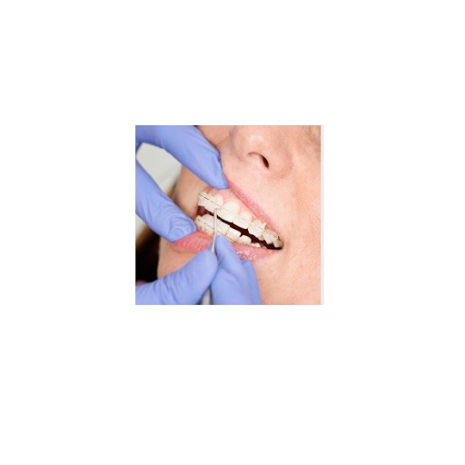 Orthodontiepraktijk De Bruyne Isabelle