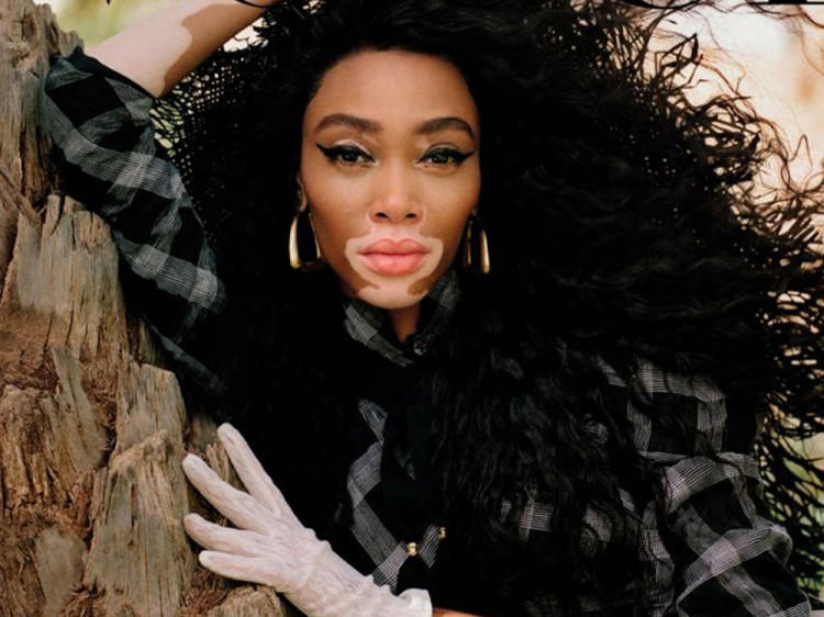Supermodel Winnie Harlow with her curly locks 