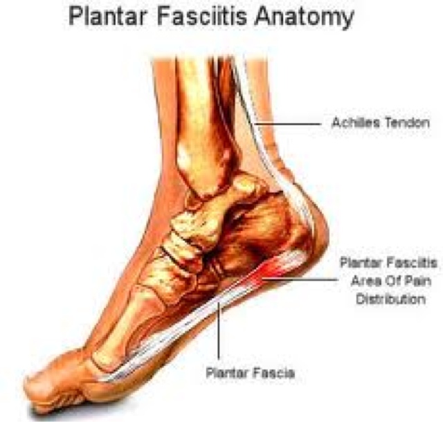 Plantar Fasciitis and Heel Pain | Foot Doctor The Woodlands Foot Doctor The  Woodlands