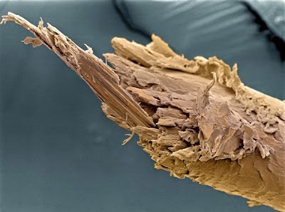 rambut Foto foto hasil scanning mikroskop elektron