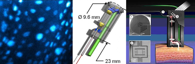 células de cuerda vocal con fluorescencia, esquema del diseño y esquema de funcionamiento