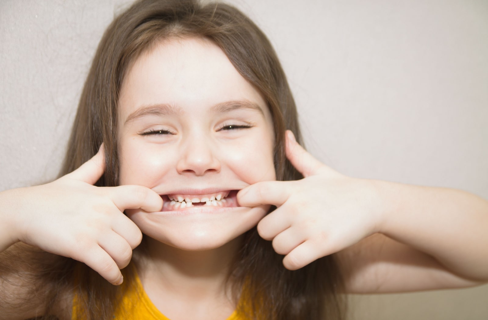 A young girl holding her mouth open to show her missing teeth