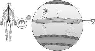 Chemotherapy-induced peripheral neuropathy: review for clinical practice*