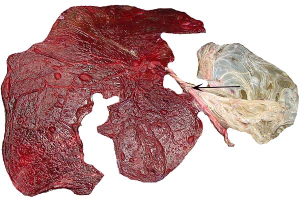 The last placenta with its extended cord and arrow pointing to the location of the nipple-like skin protrusion of amnion