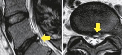 Exame de ressonância magnética da coluna vertebral