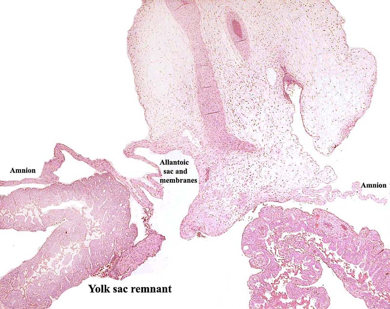 Insertion from the allantoic duct into allantois; in addition, yolk sac remnants and amnion are visible.