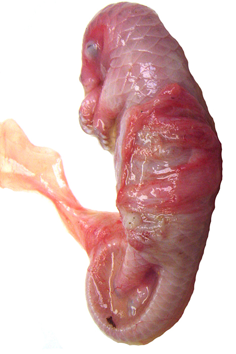 The bands (‘strips’) of villous tissue of placenta are laid over the aborted fetus.