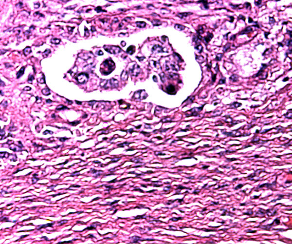 Villus in endometrial space at placental floor