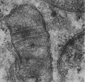 imagem de microscopia eletrônica de uma mitocôndria.