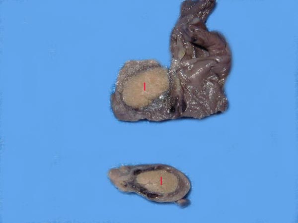 Two ovaries of an adult, nonpregnant female