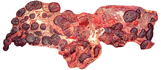 Term placenta of successful okapi gestation