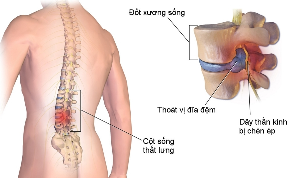 vật lý trị liệu