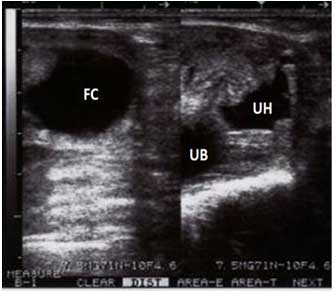 Ovarian Follicular Cyst (FC). UB: Urinary bladder. UH: Uterine horn showing accumulation of fluid in the uterine lumen (mucometra).